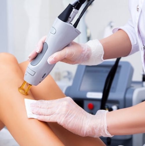 Laser hair removal Laser hair removal