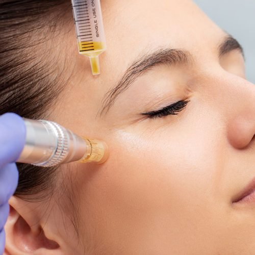 PRP treatment PRP treatment