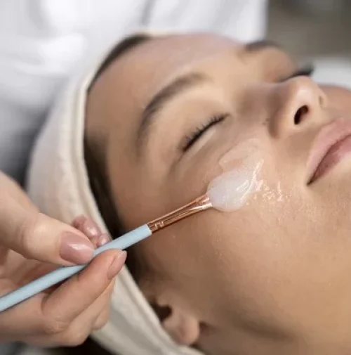 chemical-peels-for-hyperpigmentation-things-you-need-to-know chemical-peels-for-hyperpigmentation-things-you-need-to-know