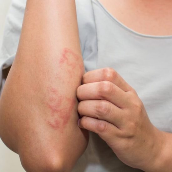 skin-allergies-treatment-1200×900 skin-allergies-treatment-1200x900